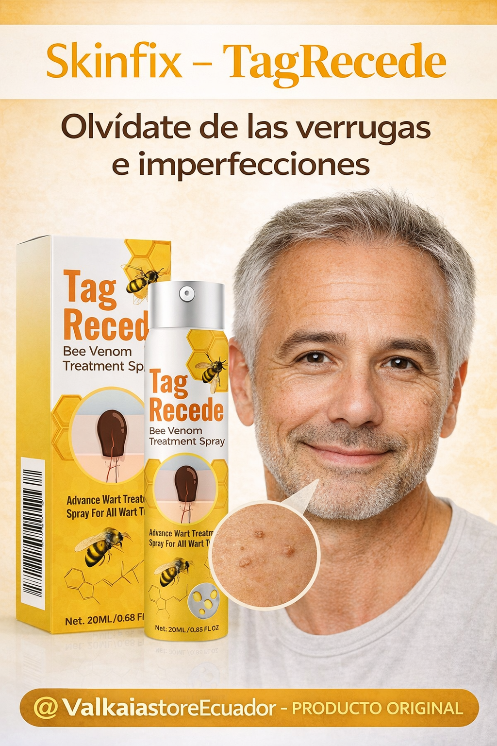 Tag Recede - Combate Verrugas e imperfecciones
